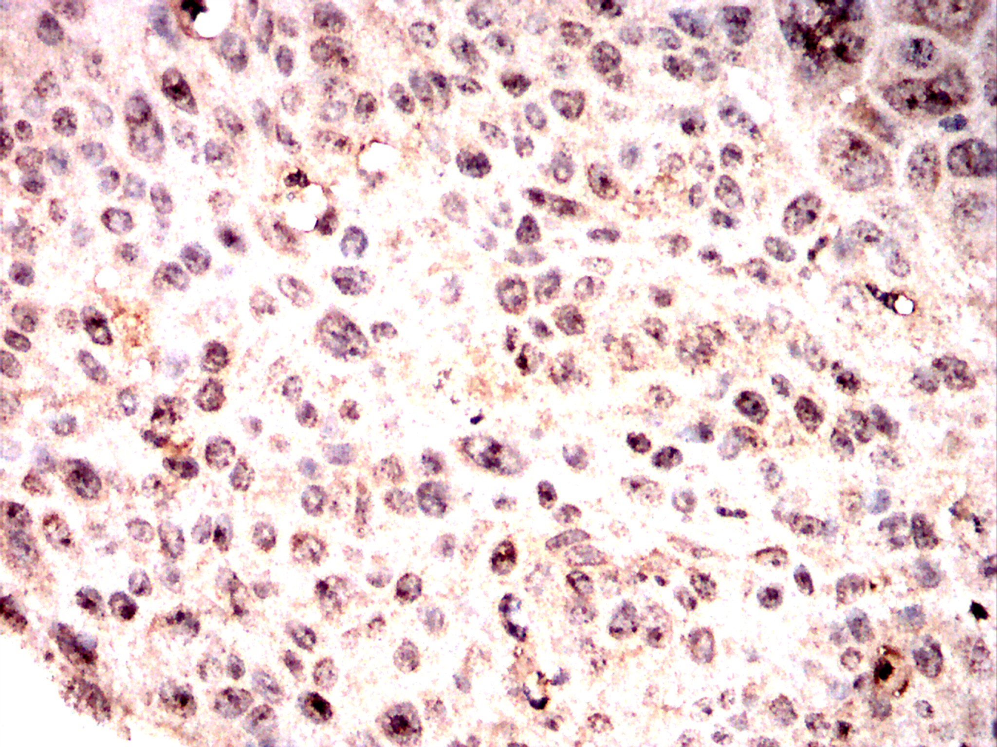 IHC